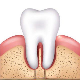 Здоровые десны и зубы